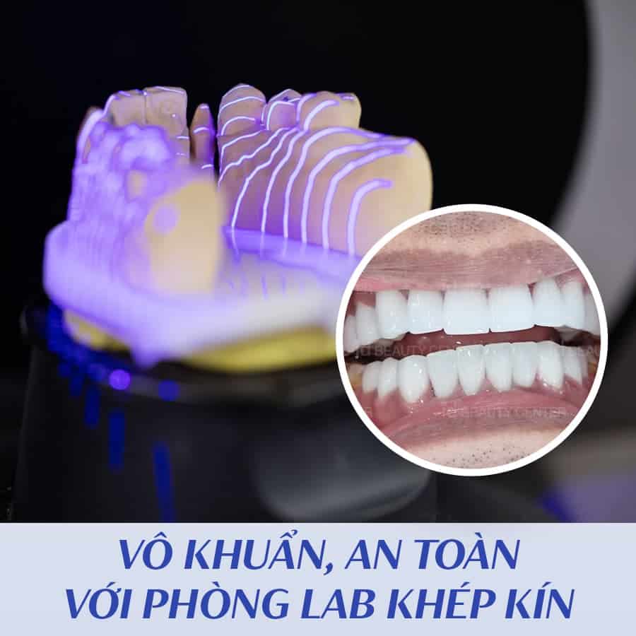 vo-khuan-an-toan-voi-phong-lab-khep-kin