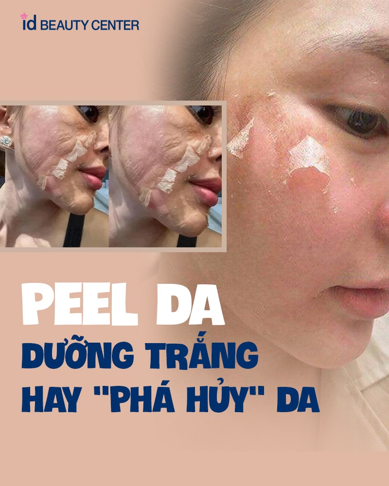 Peel da – Phương pháp làm đẹp thần kỳ hay hiểm họa phá hủy da